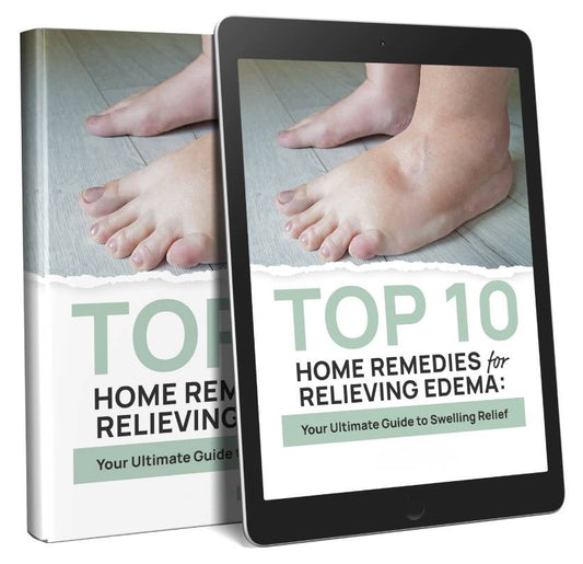 eBook on Home Remedies For Oedema